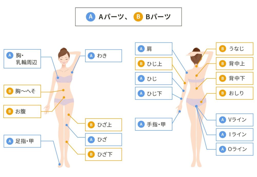 カレイドクリニック脱毛範囲