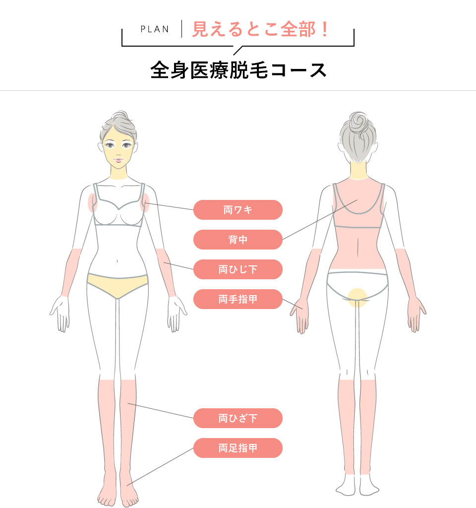 見える部位だけ！全身医療脱毛コース脱毛範囲