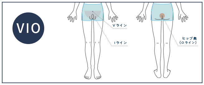 メンズじぶんクリニックVIO脱毛範囲