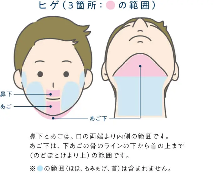 メンズじぶんクリニックヒゲ脱毛