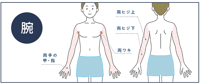 メンズじぶんクリニック腕脱毛範囲