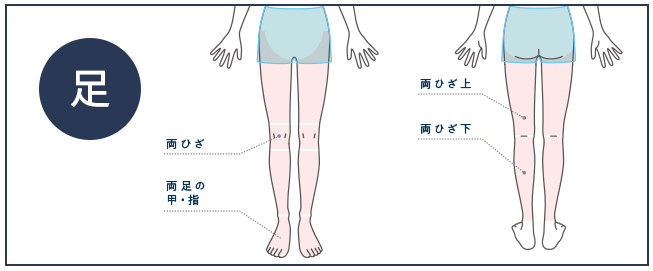 メンズじぶんクリニック足脱毛範囲