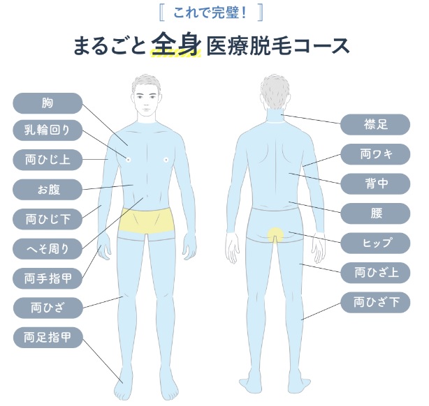 メディカルエピレーションクリニック（メディクリ）まるごと全身脱毛