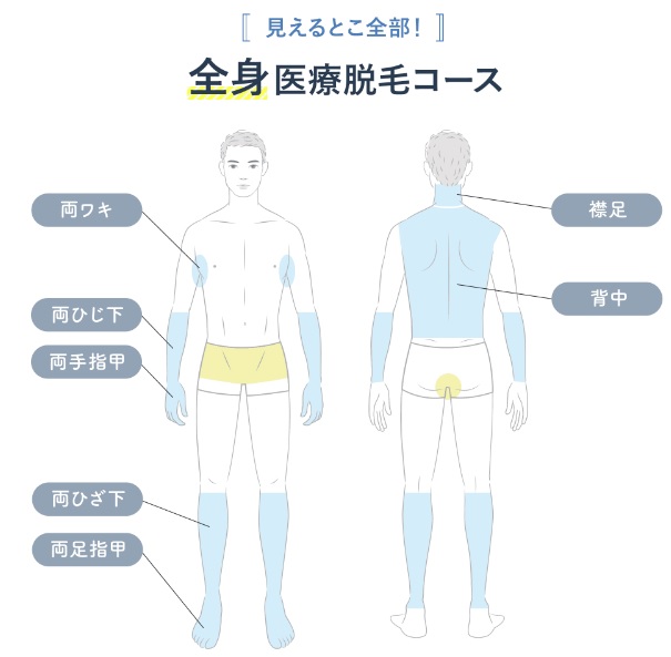 メディカルエピレーションクリニック（メディクリ）見えるとこ全部！全身脱毛