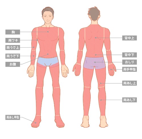 メンズミラクリニック全身脱毛