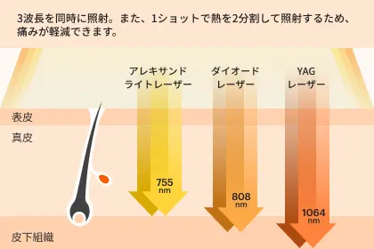 ラシャ トリニティプロレーザー